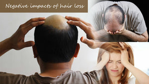 Negative Impacts of Hair Loss