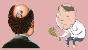Treatments and Therapies for Hair Loss