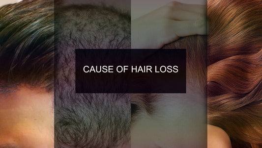 6 CAUSES OF HAIR LOSS